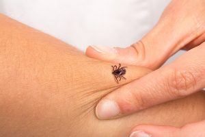 Lyme disease Treatment